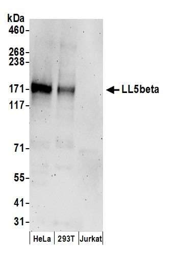 PHLDB2 Antibody (aa250-300)