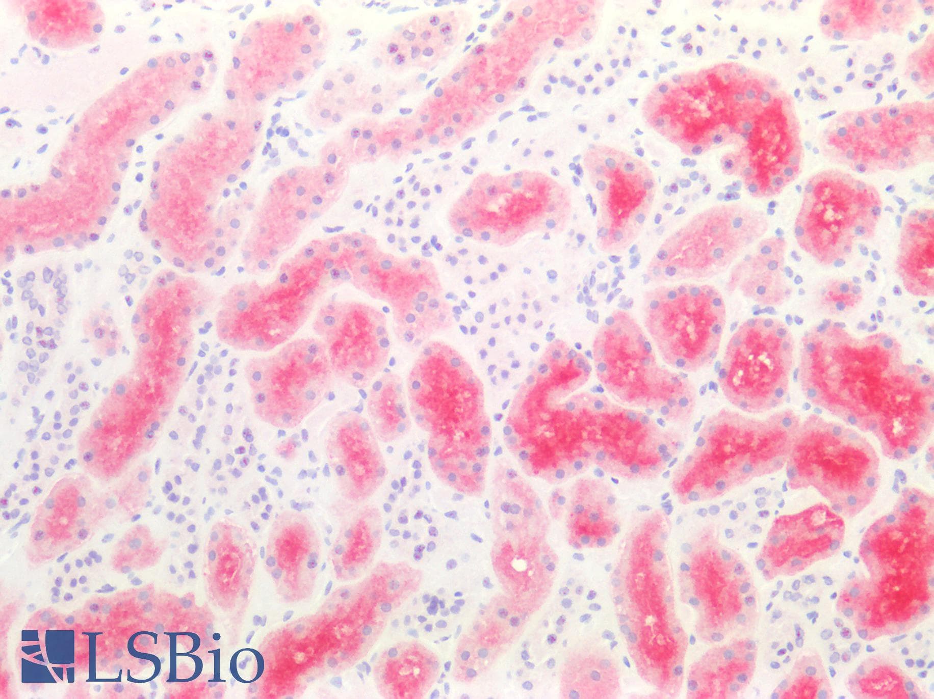IHC-plus™ MME / CD10 Antibody