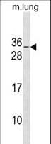 RBM7 Antibody (aa196-222)