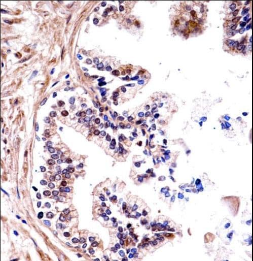 Polyclonal Rabbit anti-Human TMPRSS13 / MSP Antibody (aa431-460, IHC, WB)