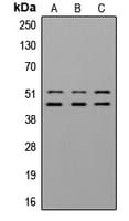 Polyclonal Rabbit anti-Human GSK3 Alpha+Beta Antibody (phospho-Tyr279/Tyr216, IHC, WB)