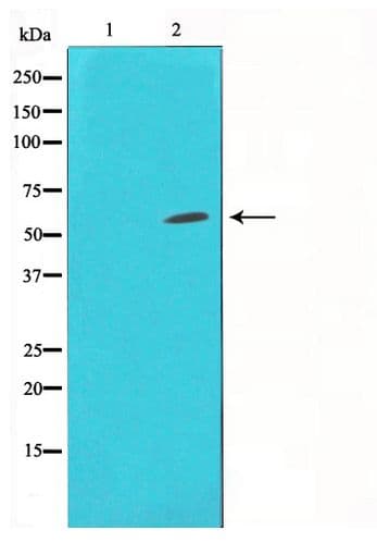 Polyclonal Rabbit anti-Human HDAC1 Antibody (IHC, IF, WB)