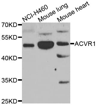 ALK2 / ACVR1 Antibody
