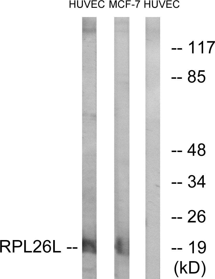 RPL26L1 Antibody