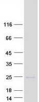 Human LTA / TNF Beta Protein (Recombinant Myc-DDK (Flag))