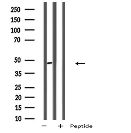 P2RY11 / P2Y11 Antibody