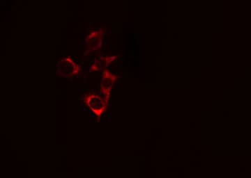 Polyclonal Rabbit anti-Human MRPS18C Antibody (IHC, IF, WB)