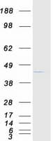 Human TNNT2 / CTNT Protein (Recombinant Myc-DDK (Flag))