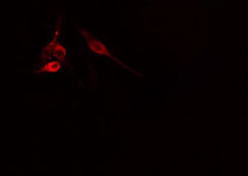 UBAC1 / KPC2 Antibody