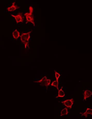 GRM4 / MGLUR4 Antibody