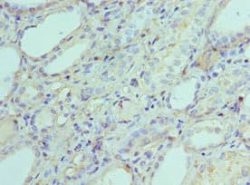 AK2 / Adenylate Kinase 2 Antibody (aa1-232)