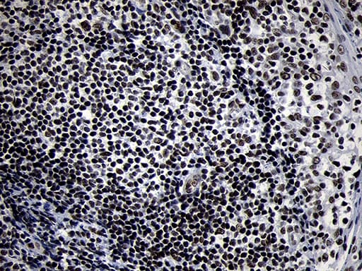 SMC1A / SMC1 Antibody (aa889-1016, clone OTI5A1)