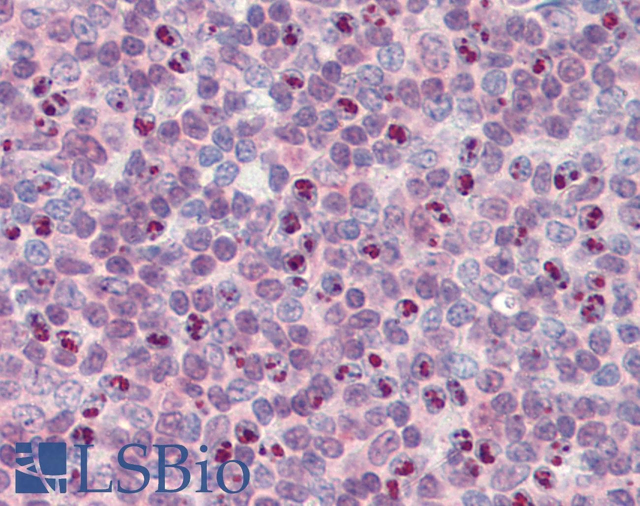 IHC-plus™ ZBTB1 Antibody