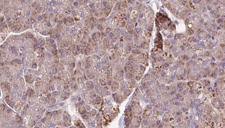 PCMT1 Antibody