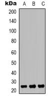 TP53INP2 Antibody (C-Terminus)