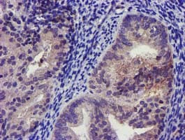 KCNJ3 / GIRK1 Antibody (clone OTI3E11)