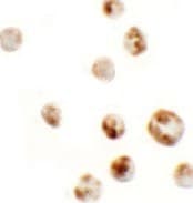 IHC-plus™ AFAP1L1 Antibody