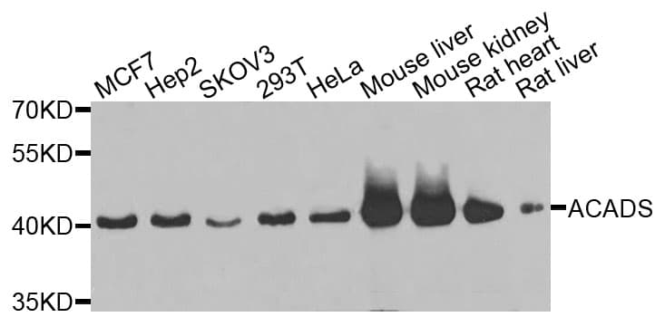 SCAD / ACADS Antibody