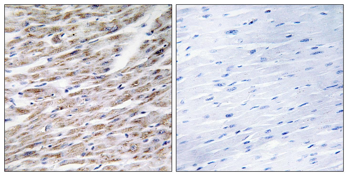 Polyclonal Rabbit anti-Human GZMA / Granzyme A Antibody (IHC, IF)