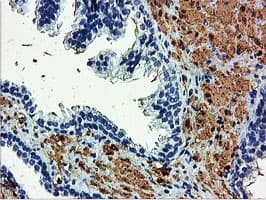 Monoclonal Mouse anti-Human TAGLN / Transgelin / SM22 Antibody (clone 8C8, Carrier-free, IHC, IF, WB)
