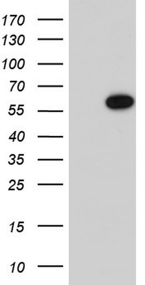 MAPKAPK5 / PRAK Antibody (aa197-471, clone OTI4H4)