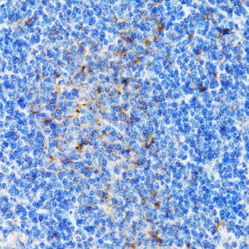 PSMD10 / Gankyrin Antibody