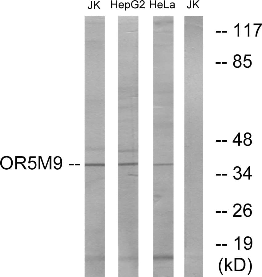 OR5M9 Antibody (aa197-246)