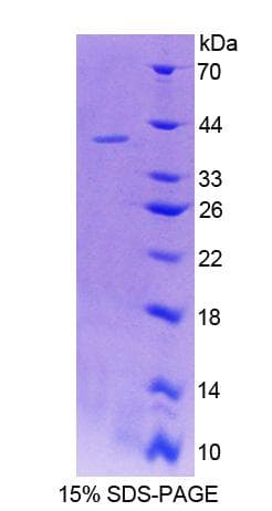 Mouse LIM2 Protein (Recombinant His-GST)