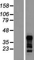 RNF126 Protein (Over-Expression Lysate Myc-DDK (Flag))