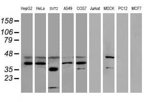 SULT1C2 / Sulfotransferase 1C2 Antibody (clone OTI5H1, Carrier-free)