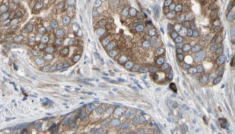 Polyclonal Rabbit anti-Human TMEPAI / PMEPA1 Antibody (IHC, IF, WB)