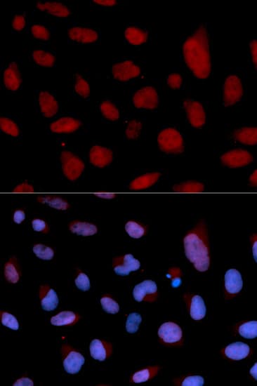 TNNC1 / Cardiac Troponin C Antibody