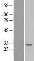 IER2 Protein (Over-Expression Lysate Myc-DDK (Flag))