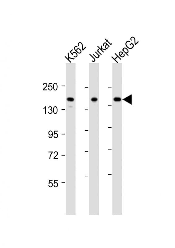 Polyclonal Rabbit anti-Human IQSEC2 Antibody (aa451-484, WB)
