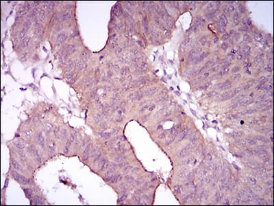ITGA2B / CD41 Antibody (aa45-149, clone 2E10C9)