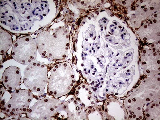 NSD3 / WHSC1L1 Antibody (aa427-566, clone OTI3B3)