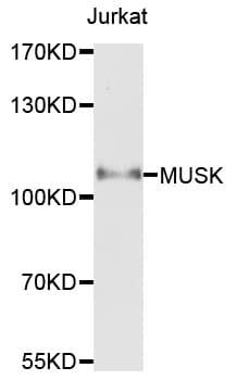 MUSK Antibody