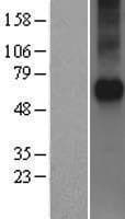 FZD5 / Frizzled 5 Protein (Over-Expression Lysate Myc-DDK (Flag))
