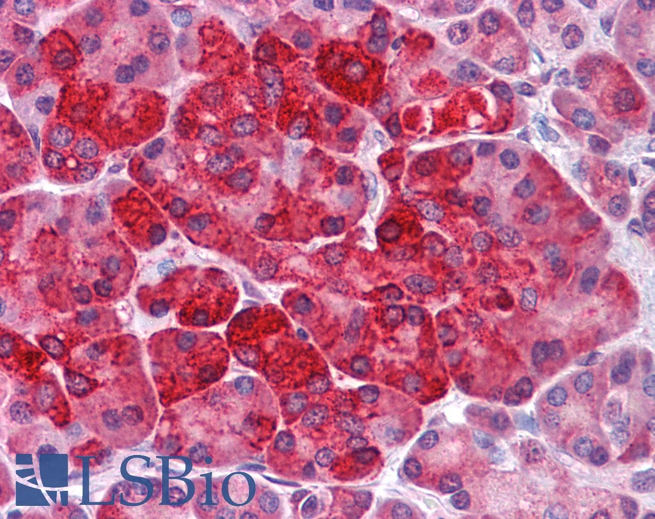 IHC-plus™ MTUS2 Antibody