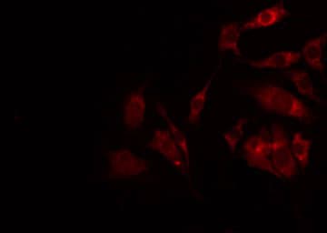 CA-VB / CA5B Antibody
