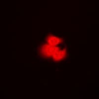 Polyclonal Rabbit anti-Human PPM1A / PP2CA Antibody (IF, WB)