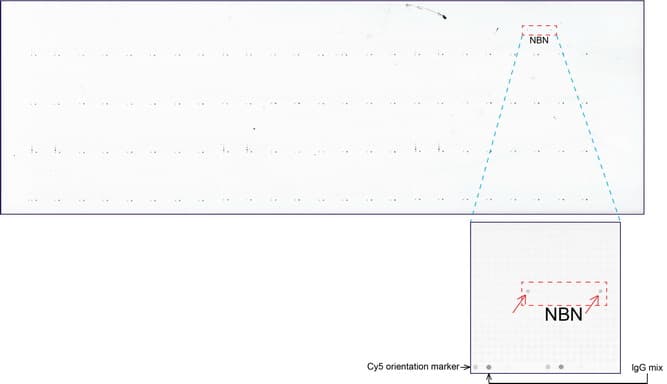 NBN / Nibrin Antibody (aa461-754, clone UMAB99)