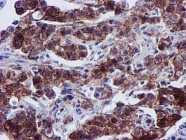 EPN2 Antibody (clone OTI1F1)