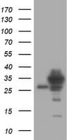 Monoclonal Mouse anti-Human SRPRB Antibody (clone OTI5G5, WB)