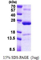 Human TNFAIP8 / SCC-S2 Protein (Recombinant His)