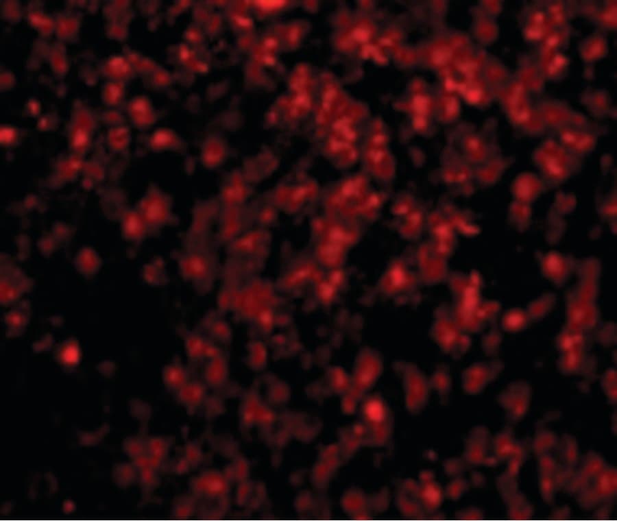 IHC-plus™ LIPE / HSL Antibody