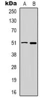 Polyclonal Rabbit anti-Human GABRD Antibody (Internal, IHC, WB)