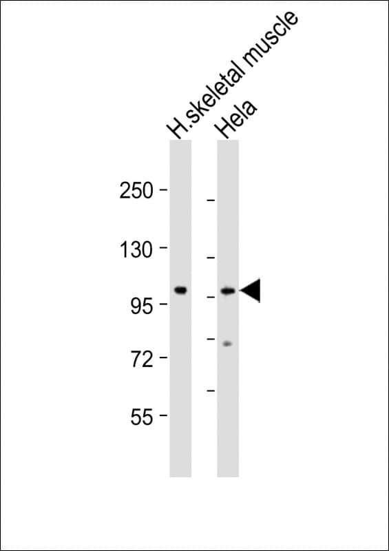 ATXN2 / SCA2 / Ataxin-2 Antibody (aa725-757)