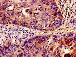 Polyclonal Rabbit anti-Human Fragilis / IFITM3 Antibody (IHC, WB)