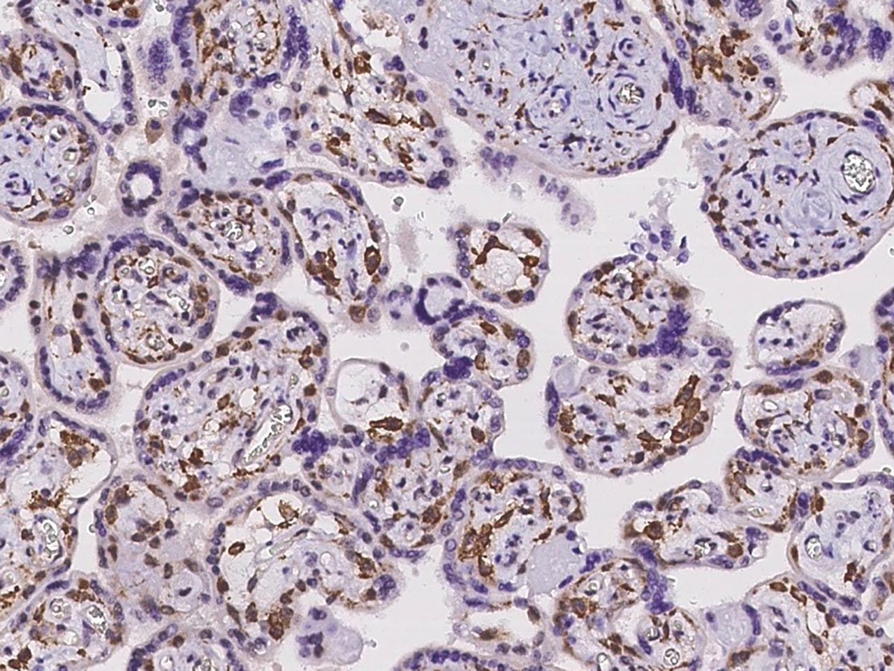 CLTA / LCA Antibody